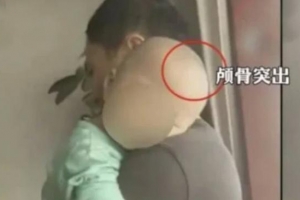 监管缺失，“大头娃娃”重现，链条式作恶丧失基本人性，需全面追责 ...
